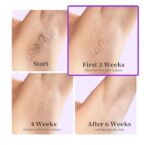 جهاز إزالة الشعر Hikyskin IPL – تبريد ثلجي، 9 مستويات طاقة، ضربات بلا حدود إزالة شعر سريع وآمن - الصورة 2