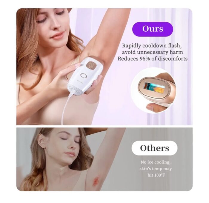 ⁦جهاز إزالة الشعر Hikyskin IPL – تبريد ثلجي، 9 مستويات طاقة، ضربات بلا حدود إزالة شعر سريع وآمن⁩ - الصورة ⁦4⁩