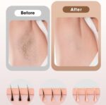 جهاز إزالة الشعر Hikyskin IPL – تبريد ثلجي، 9 مستويات طاقة، ضربات بلا حدود إزالة شعر سريع وآمن - الصورة 10