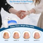 ⁦جهاز ليزر منزلي لعلاج فطريات الأظافر بموجتين ضوئيتين لتنظيف عميق وسريع⁩ - الصورة ⁦3⁩